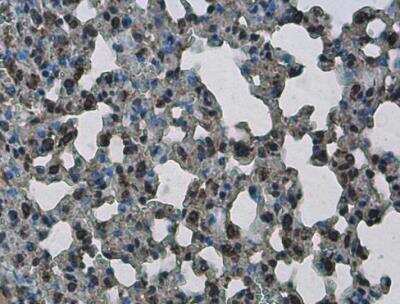 Immunohistochemistry-Paraffin: PHF10 Antibody [NBP2-19795]