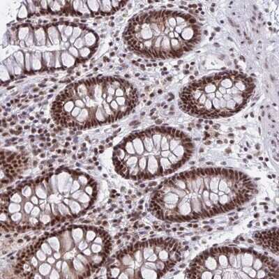 Immunohistochemistry-Paraffin: PHF10 Antibody [NBP2-33759]