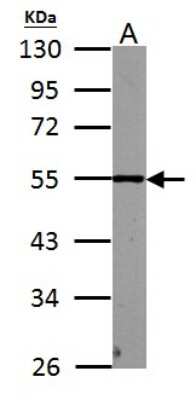 Western Blot: PHF10 Antibody [NBP2-19795]