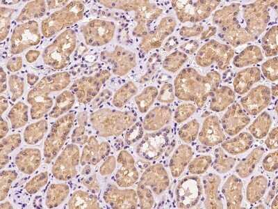 Immunohistochemistry-Paraffin: PHF11 Antibody [NBP2-97698]