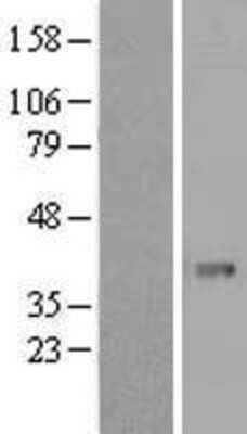 Western Blot: PHF11 Overexpression Lysate [NBL1-14353]