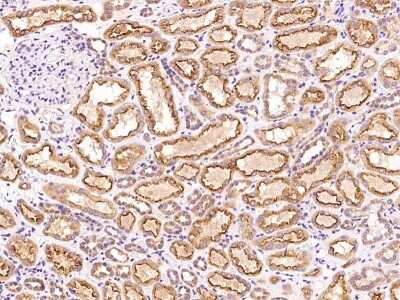 Immunohistochemistry-Paraffin: PHF13 Antibody [NBP2-97688]
