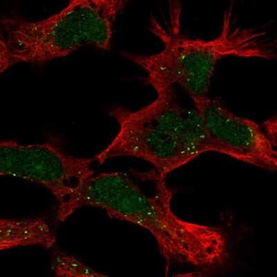 Immunocytochemistry/ Immunofluorescence: PHF14 Antibody [NBP2-68593]