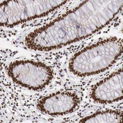 Immunohistochemistry-Paraffin: PHF14 Antibody [NBP1-81477]