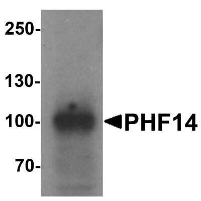 Western Blot: PHF14 AntibodyBSA Free [NBP2-81980]