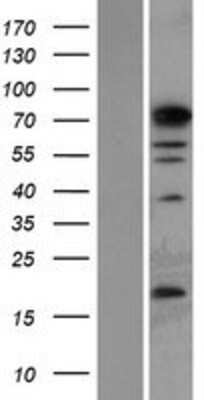 Western Blot: PHF14 Overexpression Lysate [NBP2-07296]