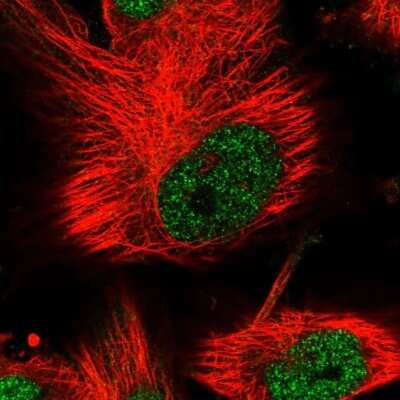 Immunocytochemistry/ Immunofluorescence: PHF15 Antibody [NBP1-81531]