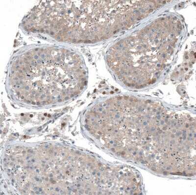 Immunohistochemistry-Paraffin: PHF15 Antibody [NBP1-81531]