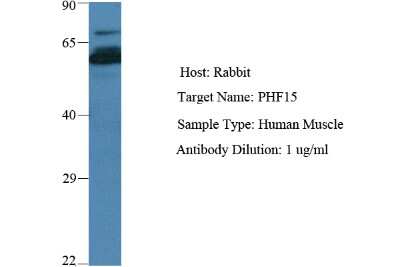 Western Blot: PHF15 Antibody [NBP2-88043]