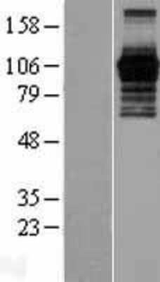 Western Blot: PHF15 Overexpression Lysate [NBL1-14355]