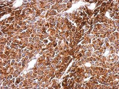 Immunohistochemistry-Paraffin: PHF16 Antibody [NBP2-19796]