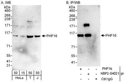 Immunoprecipitation: PHF16 Antibody [NBP2-04021]