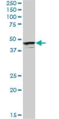 Western Blot: PHF19 Antibody [H00026147-B01P]