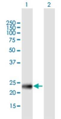 Western Blot: PHF19 Antibody [H00026147-B01P]