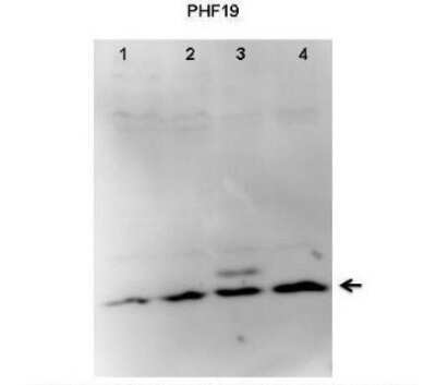 Western Blot: PHF19 Antibody [NBP1-79352]