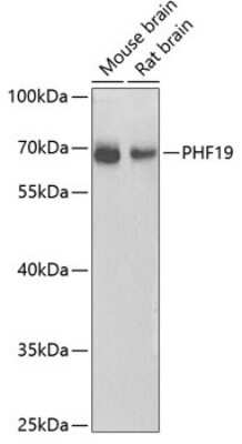 Western Blot: PHF19 AntibodyAzide and BSA Free [NBP2-93768]