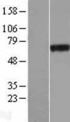 Western Blot: PHF19 Overexpression Lysate [NBP2-07134]