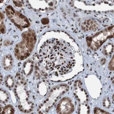 Immunohistochemistry-Paraffin: PHF2 Antibody [NBP1-83080]