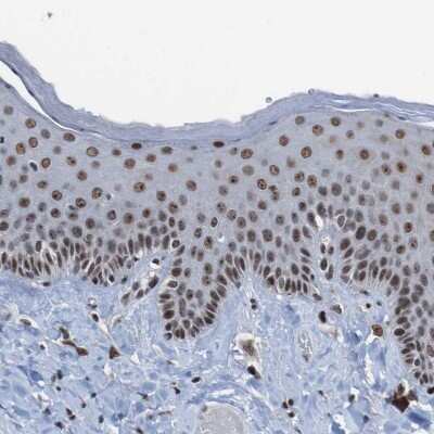 Immunohistochemistry-Paraffin: PHF2 Antibody [NBP1-83080]