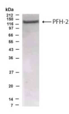 Western Blot: PHF2 AntibodyBSA Free [NB300-162]