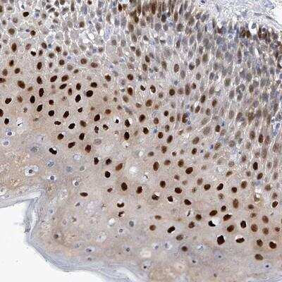 Immunohistochemistry-Paraffin: PHF20 Antibody [NBP1-88311]