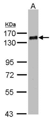 Western Blot: PHF20 Antibody [NBP1-32464]