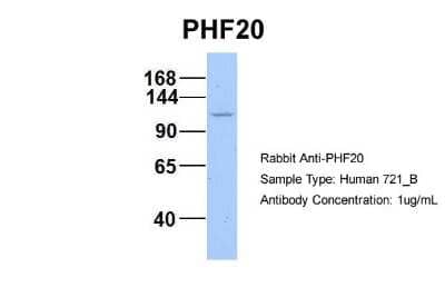 Western Blot: PHF20 Antibody [NBP2-88044]