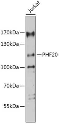 Western Blot: PHF20 AntibodyAzide and BSA Free [NBP2-93294]