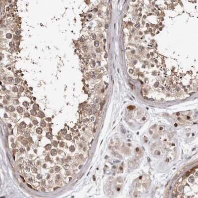 Immunohistochemistry-Paraffin: PHF20L1 Antibody [NBP1-84501]