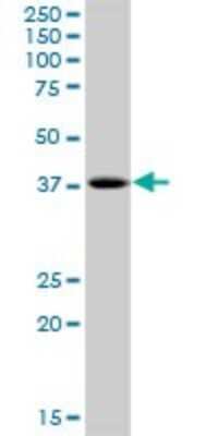 Western Blot: PHF20L1 Antibody [H00051105-B01P]