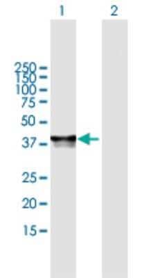 Western Blot: PHF20L1 Antibody [H00051105-B01P]