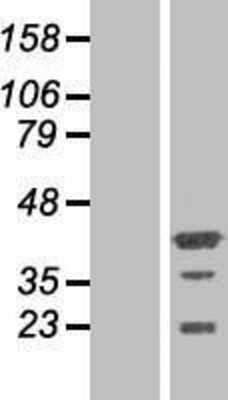 Western Blot: PHF20L1 Overexpression Lysate [NBP2-04691]