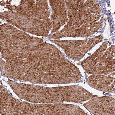 Immunohistochemistry: PHF21A Antibody [NBP1-92262]