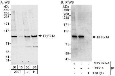 Immunoprecipitation: PHF21A Antibody [NBP2-04043]