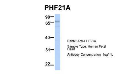 Western Blot: PHF21A Antibody [NBP2-88046]
