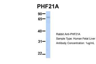 Western Blot: PHF21A Antibody [NBP2-88046]