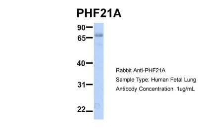 Western Blot: PHF21A Antibody [NBP2-88046]