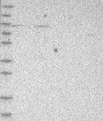 Western Blot: PHF21A Antibody [NBP3-17665]