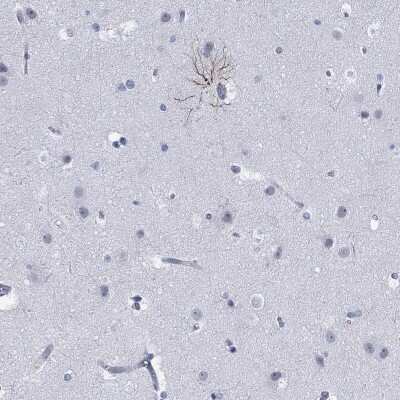 Immunohistochemistry-Paraffin: PHF21B Antibody [NBP3-17085]