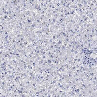 Immunohistochemistry-Paraffin: PHF21B Antibody [NBP3-17085]