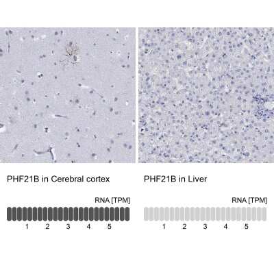 Immunohistochemistry-Paraffin: PHF21B Antibody [NBP3-17085]