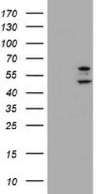 Western Blot: PHF21B Antibody (OTI3D1)Azide and BSA Free [NBP2-73367]