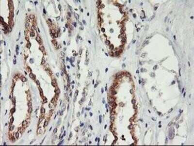 Immunohistochemistry-Paraffin: PHF21B Antibody (OTI3D1) [NBP2-00960]