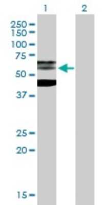 Western Blot: PHF21B Antibody [H00112885-B01P]