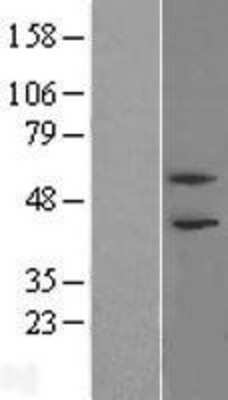 Western Blot: PHF21B Overexpression Lysate [NBL1-14358]