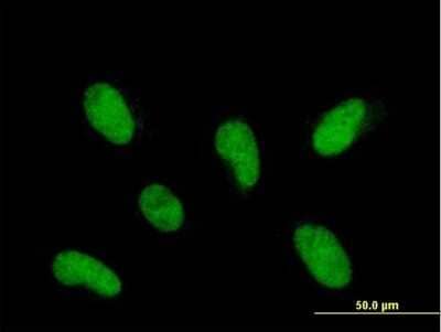 Immunocytochemistry/ Immunofluorescence: PHF22 Antibody [H00057117-B01P]