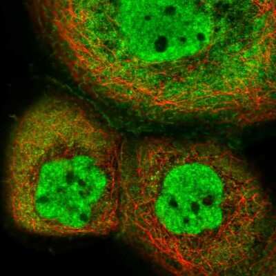 Immunocytochemistry/ Immunofluorescence: PHF22 Antibody [NBP2-58977]