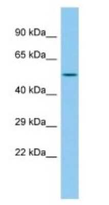 Western Blot: PHF22 Antibody [NBP3-09299]