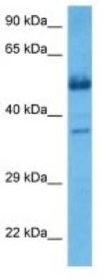 Western Blot: PHF22 Antibody [NBP3-10052]