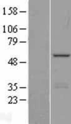 Western Blot: PHF22 Overexpression Lysate [NBL1-12009]